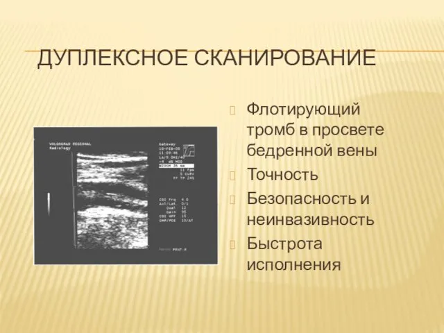 ДУПЛЕКСНОЕ СКАНИРОВАНИЕ Флотирующий тромб в просвете бедренной вены Точность Безопасность и неинвазивность Быстрота исполнения