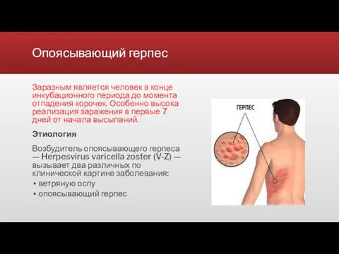 Опоясывающий герпес Заразным является человек в конце инкубационного периода до