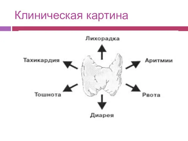 Клиническая картина