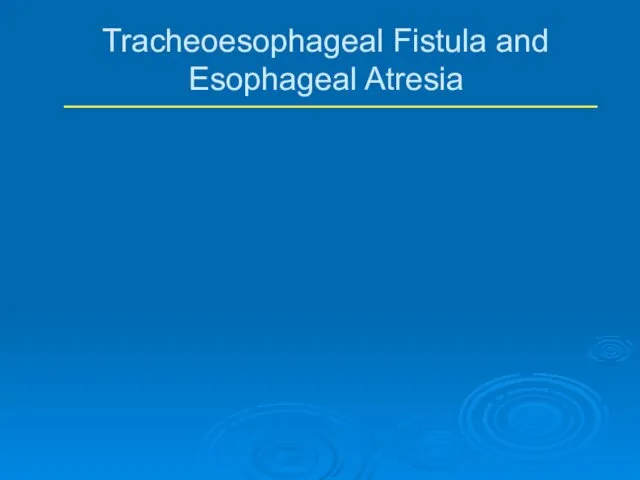 Tracheoesophageal Fistula and Esophageal Atresia