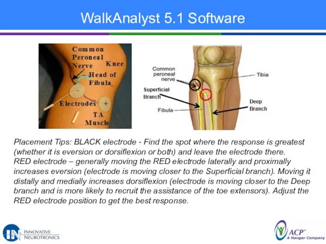 WalkAnalyst 5.1 Software Placement Tips: BLACK electrode - Find the