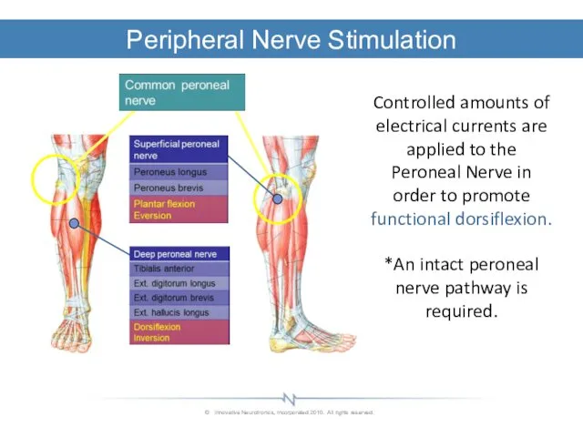 Peripheral Nerve Stimulation Controlled amounts of electrical currents are applied