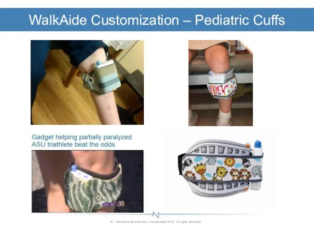 WalkAide Customization – Pediatric Cuffs