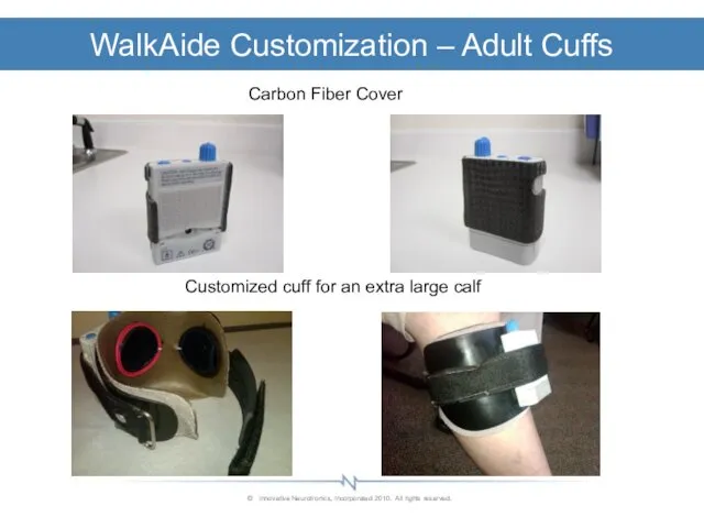 WalkAide Customization – Adult Cuffs Carbon Fiber Cover Customized cuff for an extra large calf