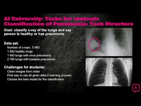 AI University: Tasks for students Classification of Pneumonia: Task Structure