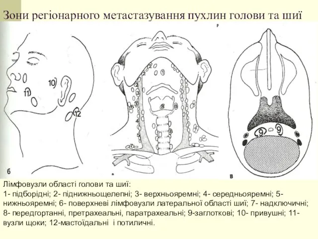 Зони регіонарного метастазування пухлин голови та шиї Лімфовузли області голови