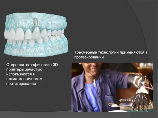 Стереолитографические 3D -принтеры зачастую используются в стоматологическом протезировании Трехмерные технологии применяются в протезировании