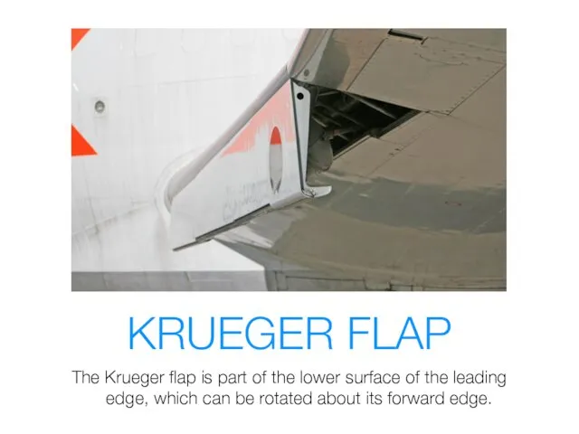 KRUEGER FLAP The Krueger flap is part of the lower