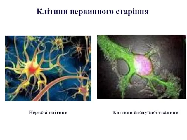 Нервові клітини Клітини сполучної тканини Клітини первинного старіння