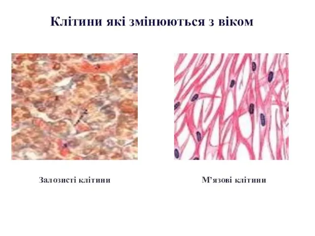 Залозисті клітини М’язові клітини Клітини які змінюються з віком