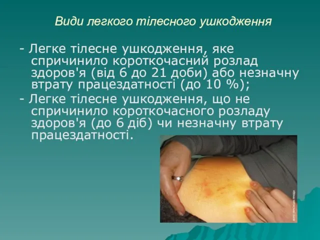 Види легкого тілесного ушкодження - Легке тілесне ушкодження, яке спричинило короткочасний розлад здоров'я