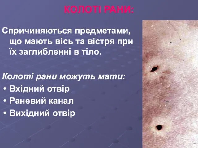 КОЛОТІ РАНИ: Спричиняються предметами, що мають вісь та вістря при