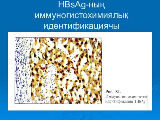 HBsAg-ның иммуногистохимиялық идентификациячы