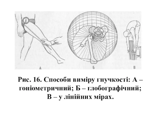 Рис. 16. Способи виміру гнучкості: А – гоніометричний; Б – глобографічний; В – у лінійних мірах.