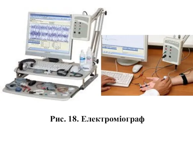 Рис. 18. Електроміограф