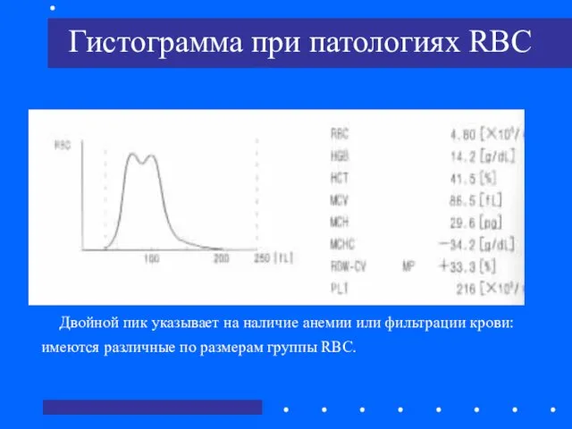 Гистограмма при патологиях RBC Двойной пик указывает на наличие анемии