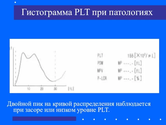 Гистограмма PLT при патологиях Двойной пик на кривой распределения наблюдается при засоре или низком уровне PLT.