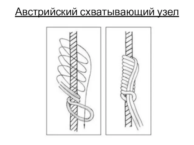 Австрийский схватывающий узел