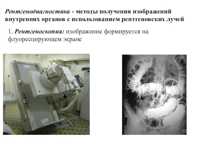 Рентгенодиагностика - методы получения изображений внутренних органов с использованием рентгеновских