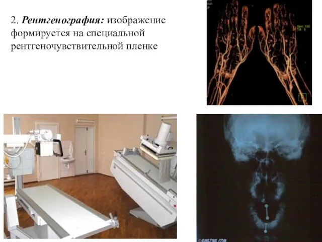 2. Рентгенография: изображение формируется на специальной рентгеночувствительной пленке