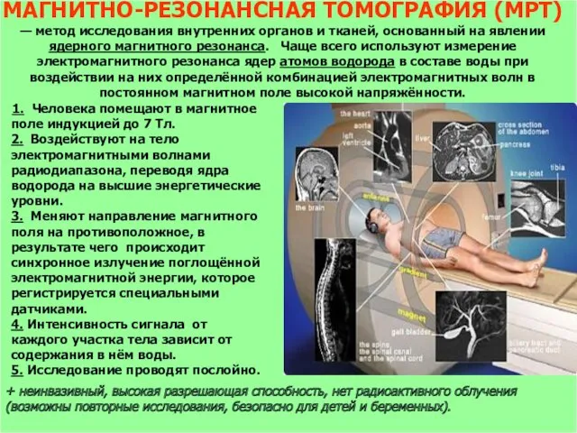 МАГНИТНО-РЕЗОНАНСНАЯ ТОМОГРАФИЯ (МРТ) — метод исследования внутренних органов и тканей, основанный на явлении