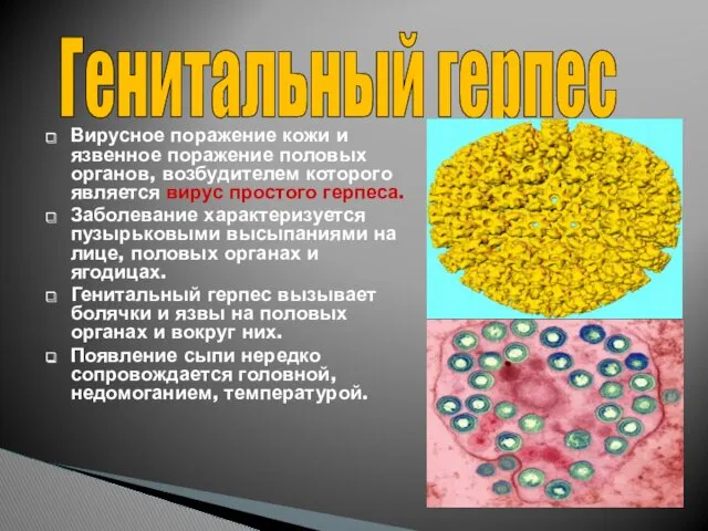 Вирусное поражение кожи и язвенное поражение половых органов, возбудителем которого