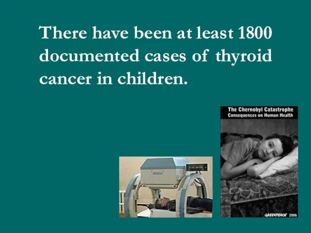 There have been at least 1800 documented cases of thyroid cancer in children.