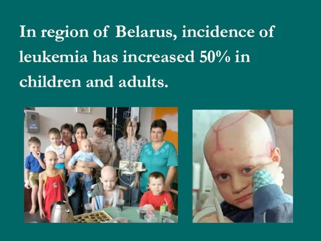 In region of Belarus, incidence of leukemia has increased 50% in children and adults.