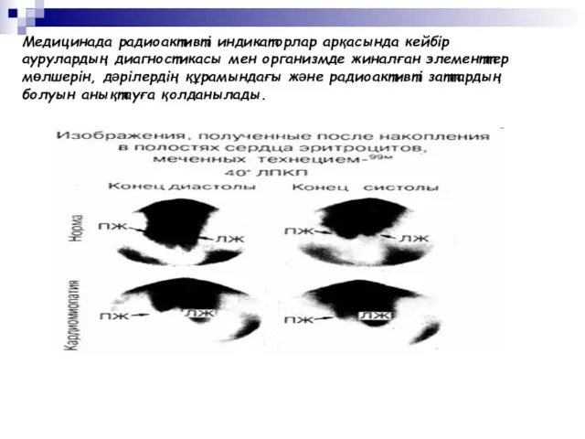 Медицинада радиоактивті индикаторлар арқасында кейбір аурулардың диагностикасы мен организмде жиналған