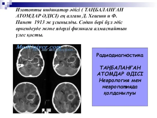 Изотопты индикатор әдісі ( ТАҢБАЛАНҒАН АТОМДАР ӘДІСІ) ең алғаш Д.