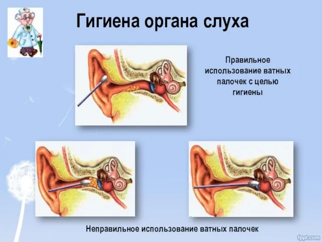 Гигиена органа слуха Правильное использование ватных палочек с целью гигиены Неправильное использование ватных палочек