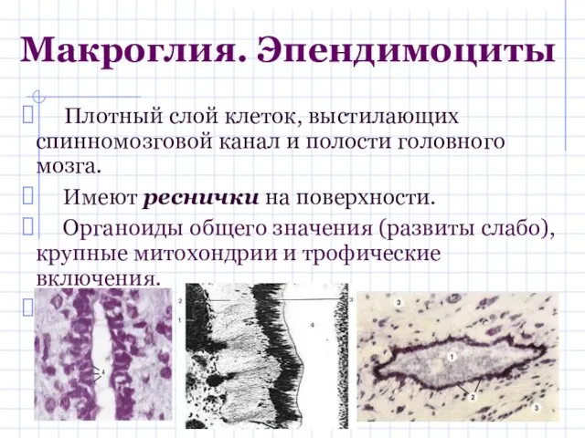 Макроглия. Эпендимоциты Плотный слой клеток, выстилающих спинномозговой канал и полости