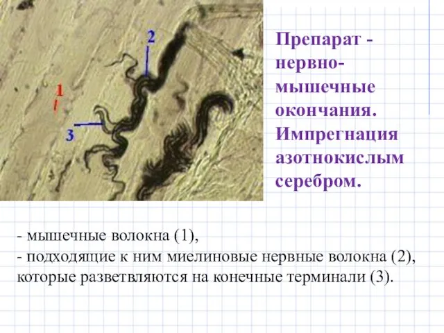 Препарат - нервно-мышечные окончания. Импрегнация азотнокислым серебром. - мышечные волокна