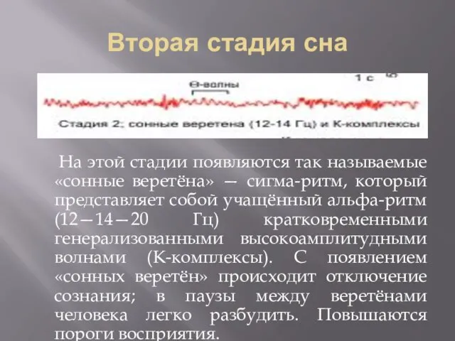 Вторая стадия сна На этой стадии появляются так называемые «сонные