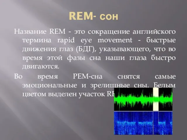 REM- сон Название REM - это сокращение английского термина rapid