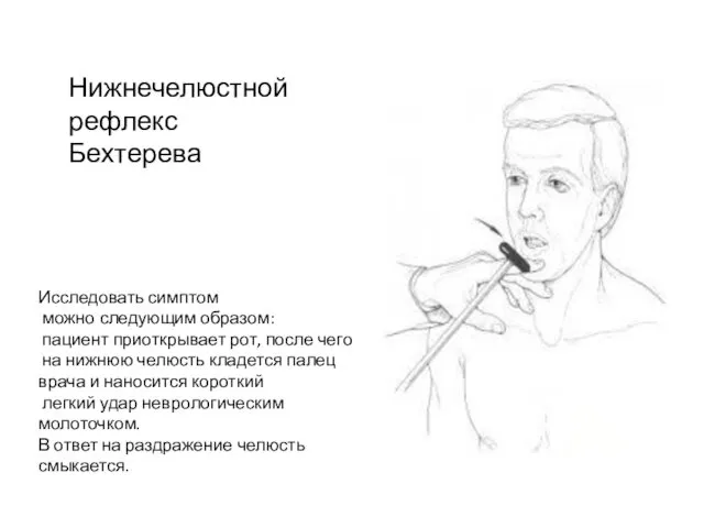 Исследовать симптом можно следующим образом: пациент приоткрывает рот, после чего