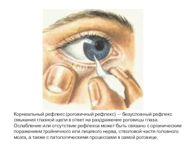 Корнеальный рефлекс (роговичный рефлекс) — безусловный рефлекс смыкания глазной щели