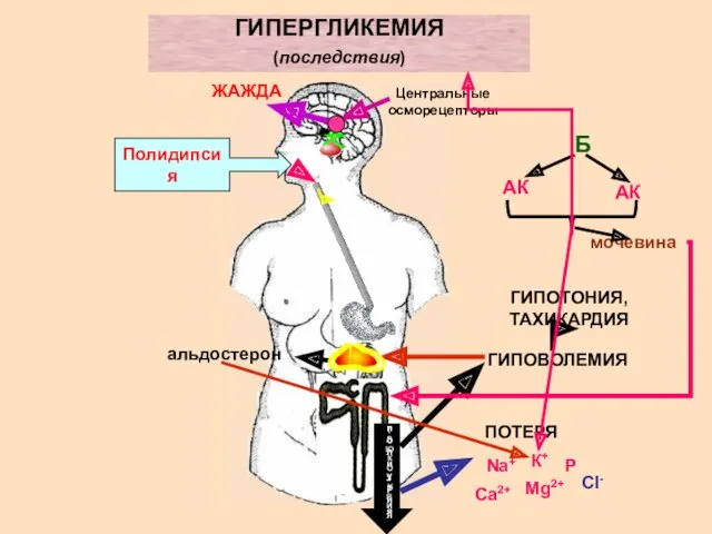 ГИПЕРГЛИКЕМИЯ (последствия) Центральные осморецепторы ЖАЖДА Полидипсия полиурия ГЛЮКОЗУРИЯ ПОТЕРЯ Na+