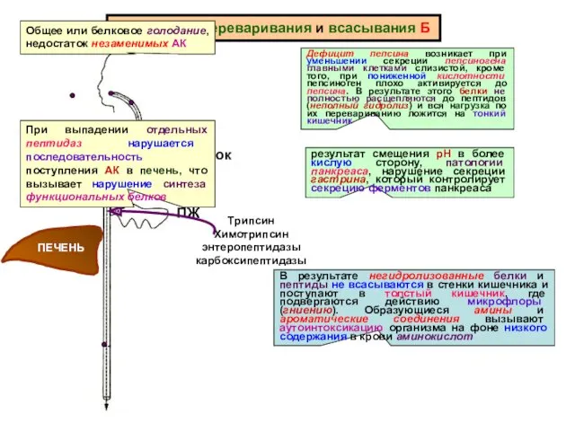 Нарушения переваривания и всасывания Б желудок Дефицит пепсина возникает при