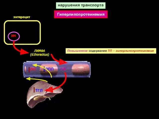 нарушения транспорта ХМ ЛИМФА (d.thoracicus) Повышенное содержание ЛП – гиперлипопротеинемия ЛП ЛПЛ ГИ Гиперлипопротеинемия энтероцит ТГЛ