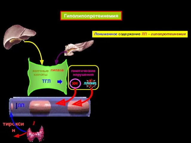 Гиполипопротеинемия желчные килоты липаза ЛП ХМ ЛПОНП ТГЛ Пониженное содержание ЛП – гипопротеинемия тироксин генетические нарушения