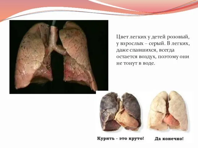 Цвет легких у детей розовый, у взрослых – серый. В