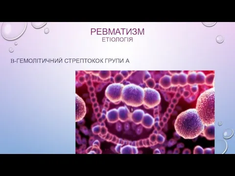 РЕВМАТИЗМ ЕТІОЛОГІЯ Β-ГЕМОЛІТИЧНИЙ СТРЕПТОКОК ГРУПИ А