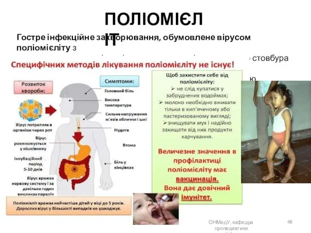 ПОЛІОМІЄЛІТ Гостре інфекційне захворювання, обумовлене вірусом поліомієліту з тропностю до