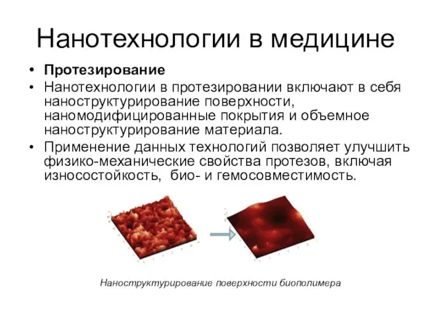 Нанотехнологии в медицине Протезирование Нанотехнологии в протезировании включают в себя