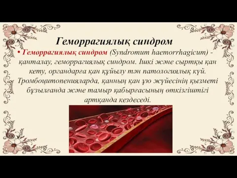 Геморрагиялық синдром Геморрагиялық синдром (Syndromum haemorrhagicum) - қанталау, геморрагиялық синдром. Ішкі және сыртқы