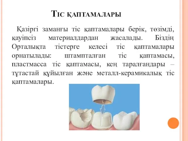 Тіс қаптамалары Қазіргі заманғы тіс қаптамалары берік, төзімді, қауіпсіз материалдардан