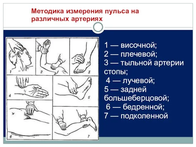 Методика измерения пульса на различных артериях 1 — височной; 2