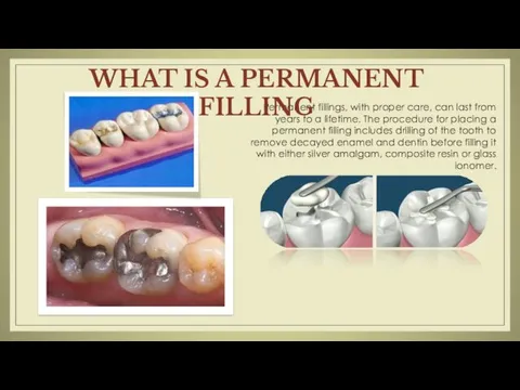 Permanent fillings, with proper care, can last from years to