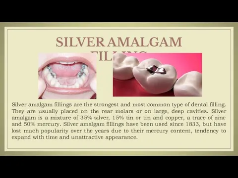 Silver amalgam fillings are the strongest and most common type